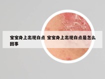 宝宝身上出现白点 宝宝身上出现白点是怎么回事