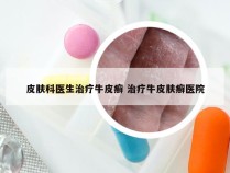 皮肤科医生治疗牛皮癣 治疗牛皮肤癣医院