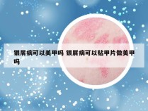 银屑病可以美甲吗 银屑病可以贴甲片做美甲吗