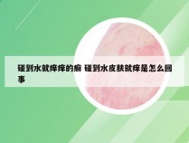 碰到水就痒痒的癣 碰到水皮肤就痒是怎么回事