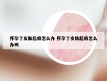 怀孕了皮肤起癣怎么办 怀孕了皮肤起癣怎么办啊