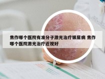 焦作哪个医院有准分子激光治疗银屑病 焦作哪个医院激光治疗近视好