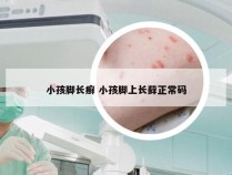 小孩脚长癣 小孩脚上长藓正常码