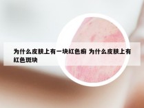 为什么皮肤上有一块红色癣 为什么皮肤上有红色斑块