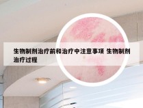 生物制剂治疗前和治疗中注意事项 生物制剂治疗过程