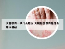 大腿根白一块什么原因 大腿根部发白是什么原因引起