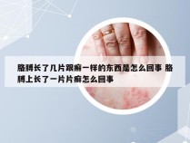 胳膊长了几片跟癣一样的东西是怎么回事 胳膊上长了一片片癣怎么回事