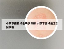 小孩下面有红色块状像癣 小孩下面红是怎么回事啊