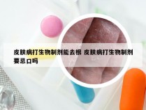 皮肤病打生物制剂能去根 皮肤病打生物制剂要忌口吗