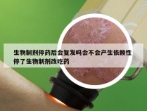 生物制剂停药后会复发吗会不会产生依赖性 停了生物制剂改吃药