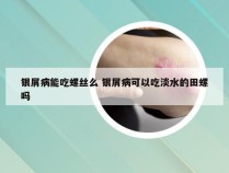 银屑病能吃螺丝么 银屑病可以吃淡水的田螺吗