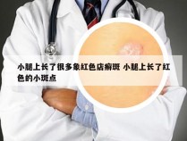 小腿上长了很多象红色店癣斑 小腿上长了红色的小斑点