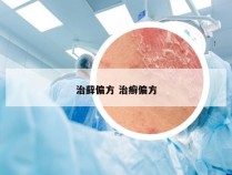 治藓偏方 治癣偏方