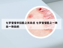 七岁宝宝半拉脸上长白点 七岁宝宝脸上一块白一块白的