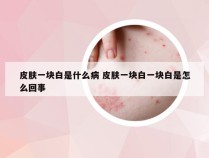 皮肤一块白是什么病 皮肤一块白一块白是怎么回事