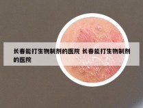 长春能打生物制剂的医院 长春能打生物制剂的医院