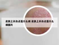 皮肤上长白点是什么病 皮肤上长白点是什么病图片