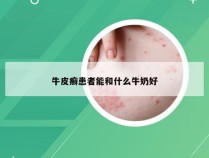 牛皮癣患者能和什么牛奶好