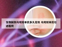 生物制剂乌司奴单抗多久见效 乌司奴单抗引进医院