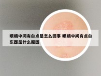 眼睛中间有白点是怎么回事 眼睛中间有点白东西是什么原因