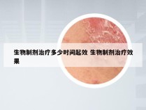 生物制剂治疗多少时间起效 生物制剂治疗效果