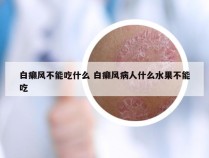 白癞风不能吃什么 白癞风病人什么水果不能吃