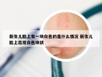 新生儿脸上有一块白色的是什么情况 新生儿脸上出现白色块状