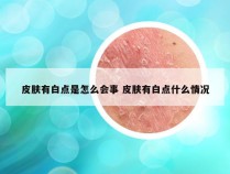 皮肤有白点是怎么会事 皮肤有白点什么情况