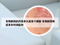 生物制剂的药用多久能有个缓解 生物制剂用后多长时间起效