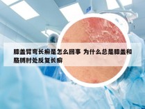 膝盖臂弯长癣是怎么回事 为什么总是膝盖和胳膊肘处反复长癣