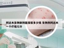 阿达木生物制剂医保报多少钱 生物剂阿达木一个疗程几针