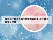 夏天孩子身上长癣小痘痘怎么回事 孩子身上夏天长疙瘩