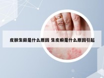 皮肤生藓是什么原因 生皮癣是什么原因引起