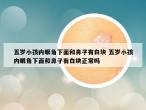 五岁小孩内眼角下面和鼻子有白块 五岁小孩内眼角下面和鼻子有白块正常吗