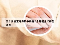 三个月宝宝好像长牛皮癣 3个月婴儿长癣怎么办