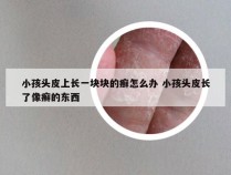 小孩头皮上长一块块的癣怎么办 小孩头皮长了像癣的东西