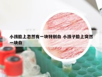 小孩脸上忽然有一块特别白 小孩子脸上突然一块白