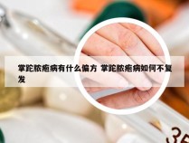 掌跎脓疱病有什么偏方 掌跎脓疱病如何不复发