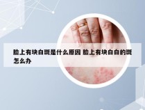 脸上有块白斑是什么原因 脸上有块白白的斑怎么办