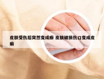 皮肤受伤后突然变成癣 皮肤破损伤口变成皮癣