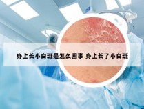 身上长小白斑是怎么回事 身上长了小白斑