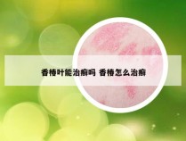 香椿叶能治癣吗 香椿怎么治癣