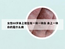 女性68岁身上现在有一块一块白 身上一块白的是什么病