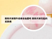 新陈代谢慢牛皮癣会加重吗 新陈代谢引起的皮肤病