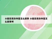 小腿出现白块是怎么回事 小腿出现白块是怎么回事啊