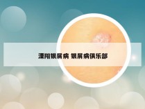 溧阳银屑病 银屑病俱乐部