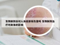 生物制剂会对人体皮肤有伤害吗 生物制剂治疗对身体的影响