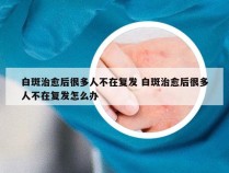 白斑治愈后很多人不在复发 白斑治愈后很多人不在复发怎么办