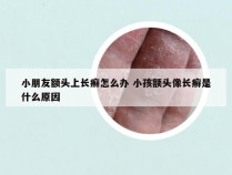 小朋友额头上长癣怎么办 小孩额头像长癣是什么原因