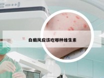 白癜风应该吃哪种维生素